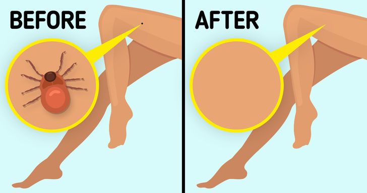 1c2b4a53ebbfed68e9099e8005