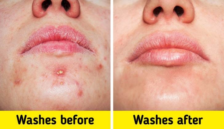 25a91453e7a92556918107b923