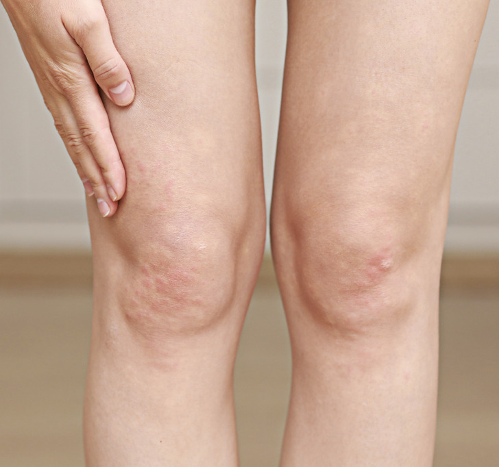 2681a45d8593a6cfccf38304ac