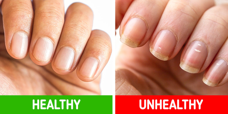 3811145fdf838e42957158111d