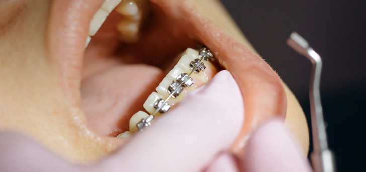 3c52df5637a0249f7a0866e570