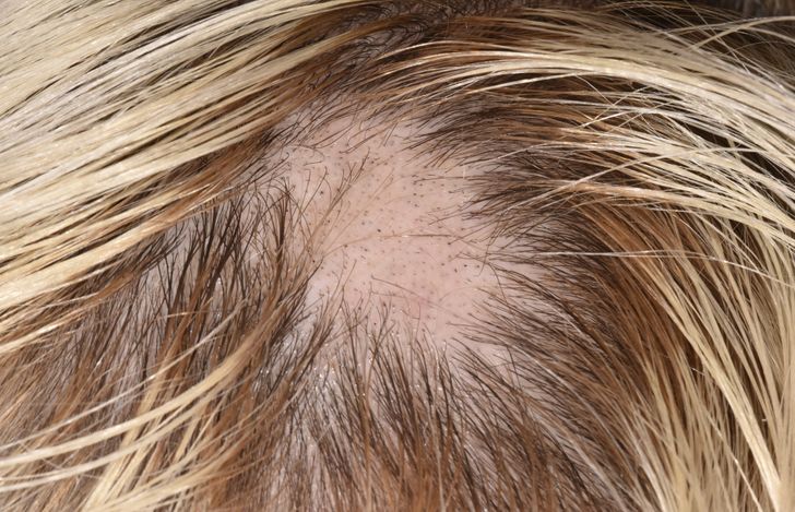 40b46f51a2ab661c6a4f503be5