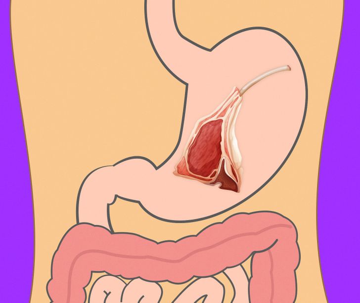 481ff1581bb53e0087cbbb3703