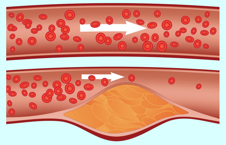 4d9ba05f5bb7df1bd64348e62d