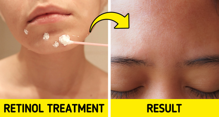 647d01562b88622e38c4c46c74