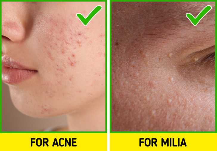 67b6af5357a81238fdf1d82216