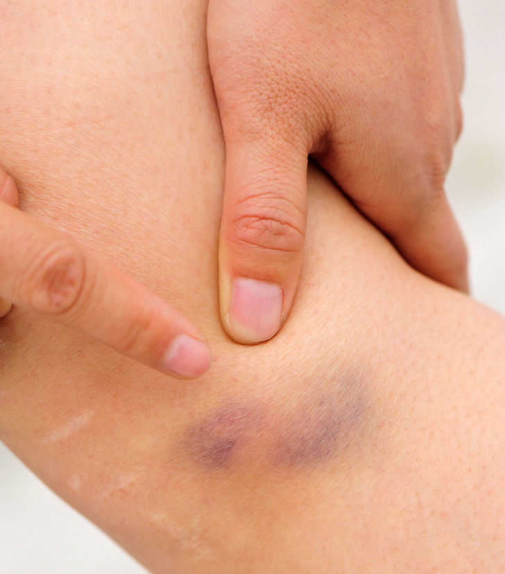 70ee1b5c69bfddcff25cb10241