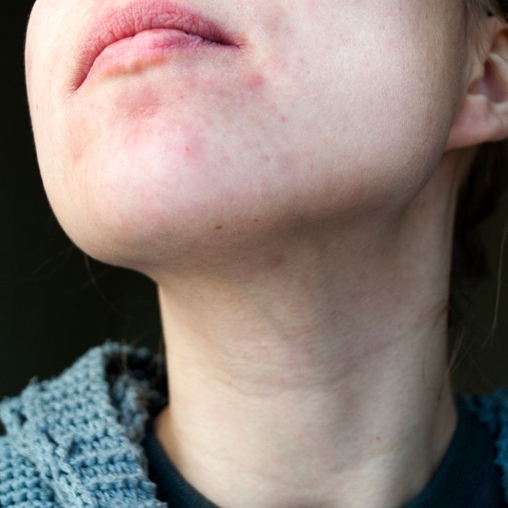 7d79ce563fbfe3b9051d2d103a