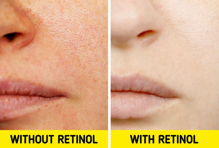 7e34be599a96ddeac6d8b1de38