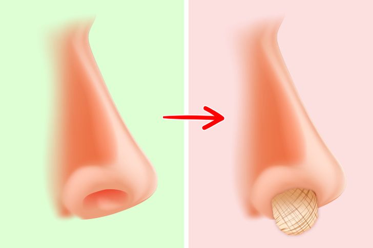 86a65353fd8ed49bdd768c0a5b