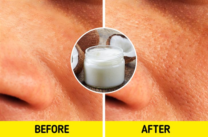 8a8bcc518cb4245c0885261fac