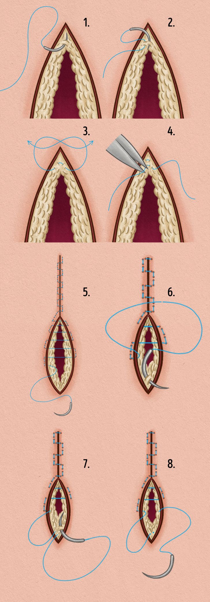 90256b5ab6a59dcc648dd7c4a5