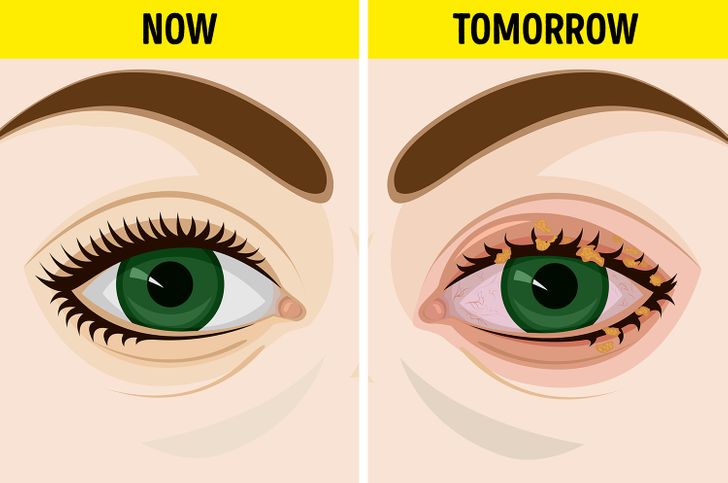 99eada581aa58159d70248338d