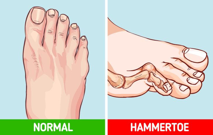 b1147a542597ca7b2d4f3d808a