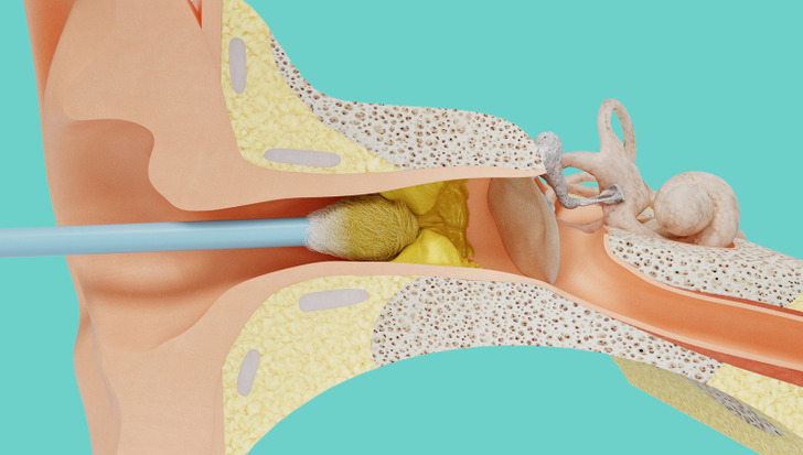 b96e5558d390d0e120c034d729 b96e5558d390d0e120c034d729