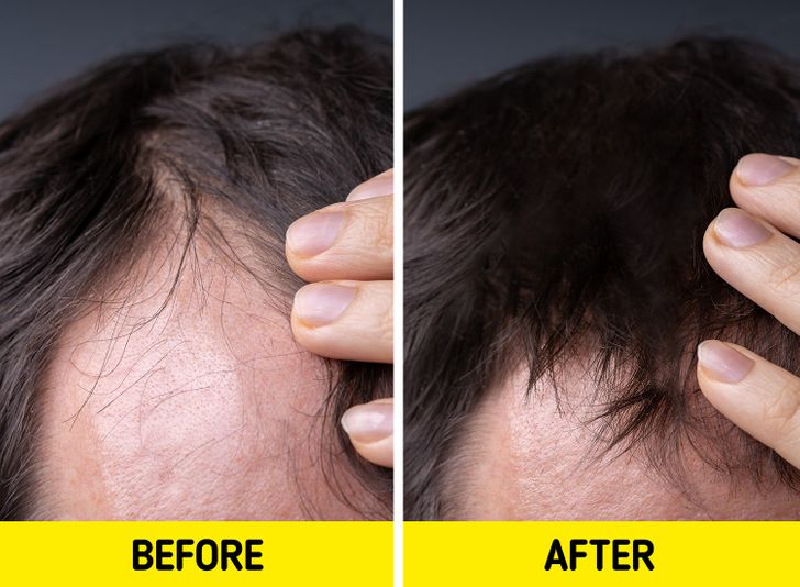 ca41c85d5d86645b9dead02c00