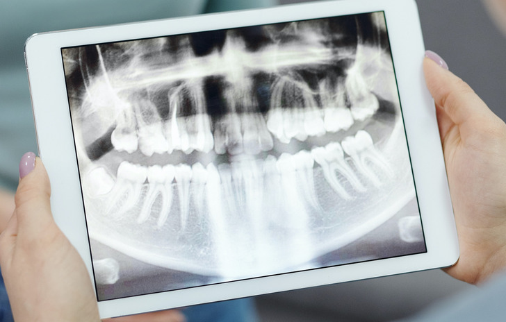 e1ae125b8a801033f6a1427fef