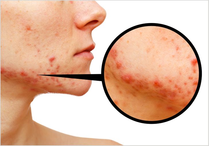 e2fd115c6b87a234663e7ddda8