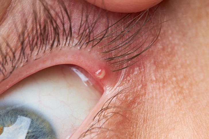 fa81af514f916d0e845a19fd1f